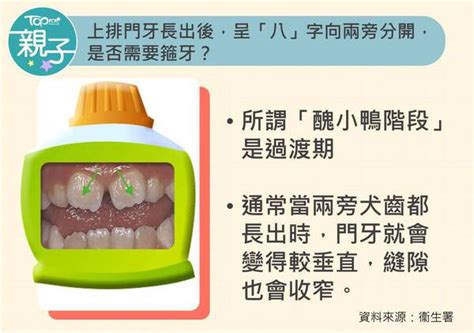 2歲出大牙|【兒童換牙】小朋友幾歲出牙換牙？ 一文看清兒童換。